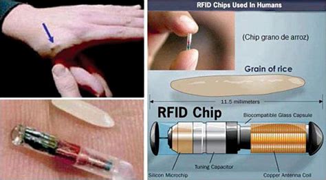 rfid chip what does it do|rfid chips for sale.